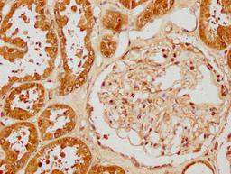 IHC image of CSB-PA010429PA31nforHU diluted at 1:40 and staining in paraffin-embedded human kidney tissue performed on a Leica BondTM system. After dewaxing and hydration, antigen retrieval was mediated by high pressure in a citrate buffer (pH 6.0). Section was blocked with 10% normal goat serum 30min at RT. Then primary antibody (1% BSA) was incubated at 4°C overnight. The primary is detected by a biotinylated secondary antibody and visualized using an HRP conjugated SP system.