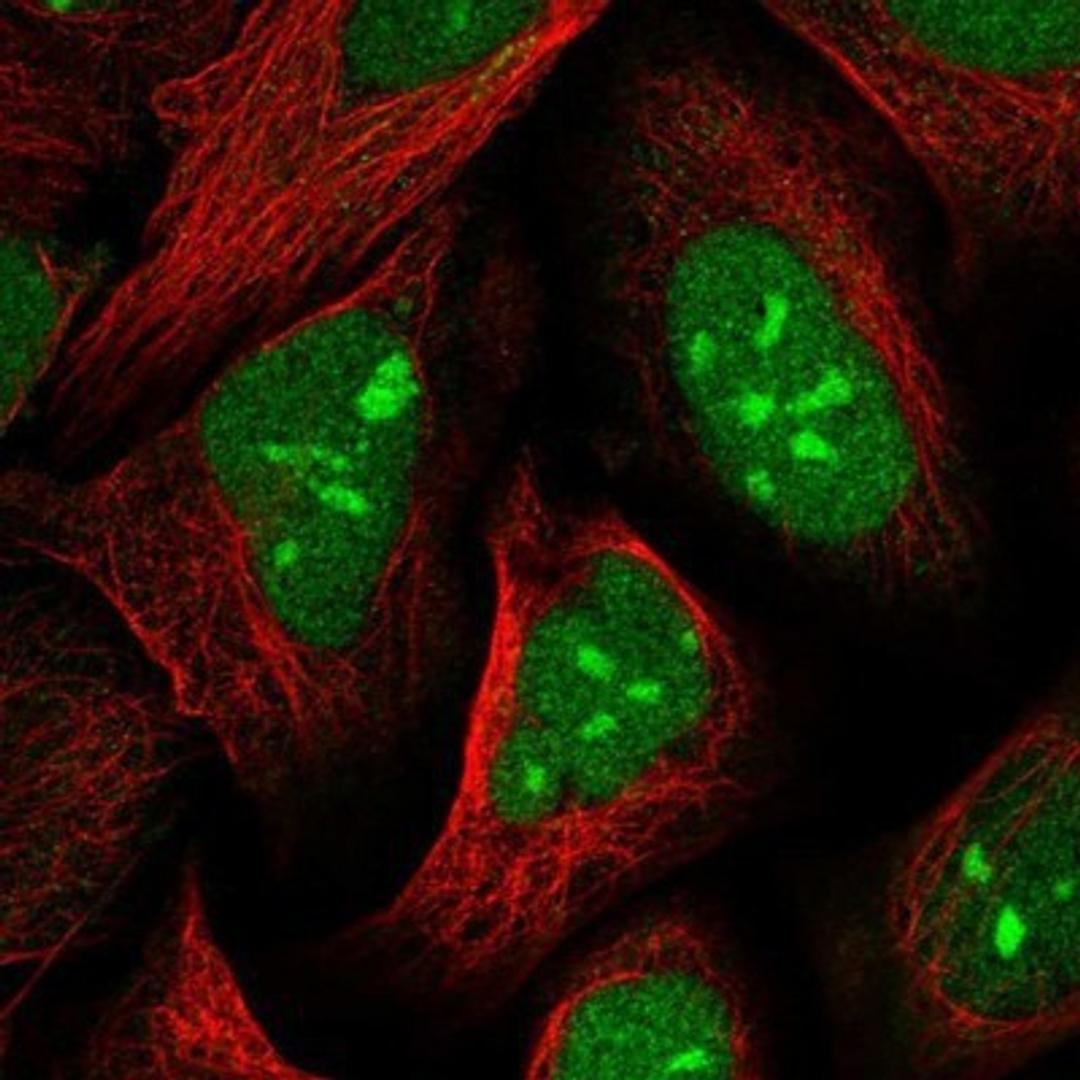 Immunocytochemistry/Immunofluorescence: UBLCP1 Antibody [NBP1-85468] - Staining of human cell line U-2 OS shows positivity in nucleus & nucleoli.