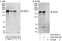 Detection of human TRPS1 by western blot and immunoprecipitation.