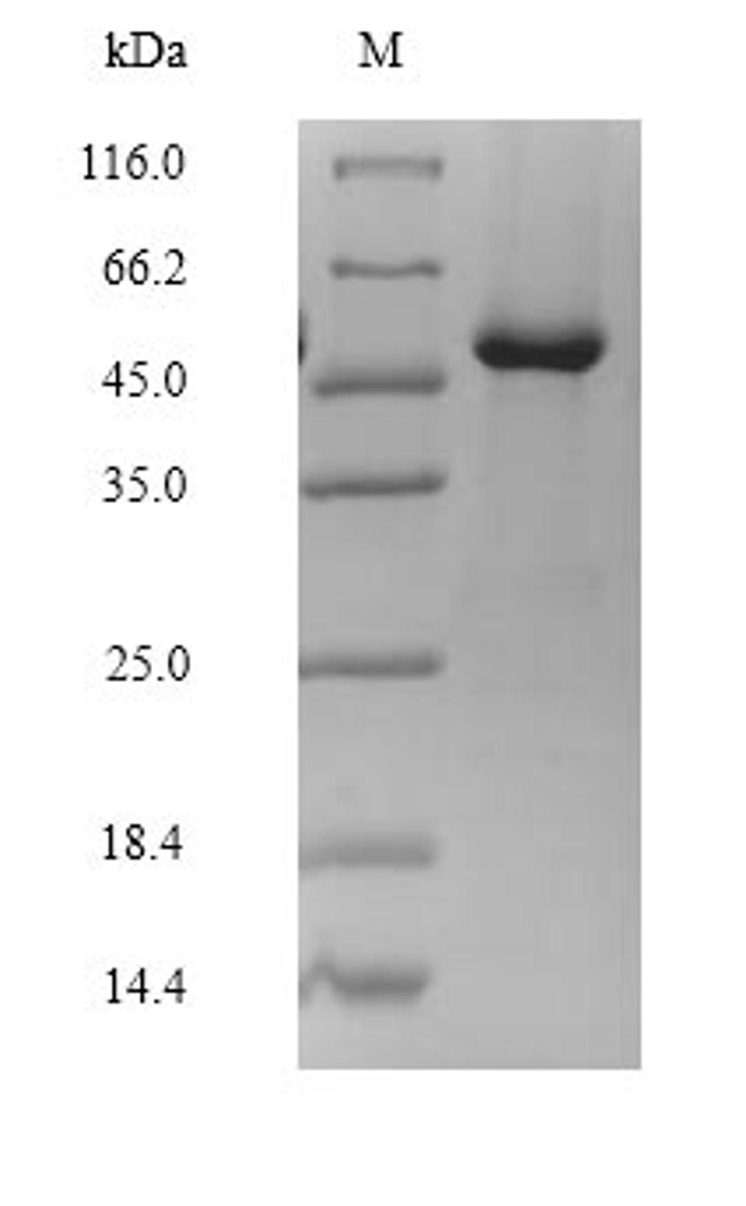 (Tris-Glycine gel) Discontinuous SDS-PAGE (reduced) with 5% enrichment gel and 15% separation gel.