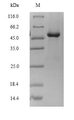 (Tris-Glycine gel) Discontinuous SDS-PAGE (reduced) with 5% enrichment gel and 15% separation gel.