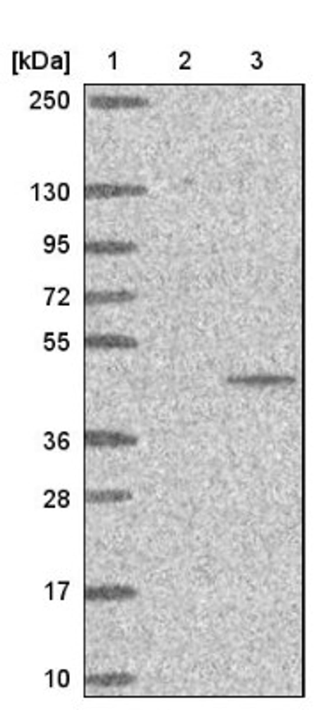 Western Blot: PTER Antibody [NBP1-86264] - Lane 1: Marker [kDa] 250, 130, 95, 72, 55, 36, 28, 17, 10<br/>Lane 2: Negative control (vector only transfected HEK293T lysate)<br/>Lane 3: Over-expression lysate (Co-expressed with a C-terminal myc-DDK tag (~3.1 kDa) in mammalian HEK293T cells, LY424361)