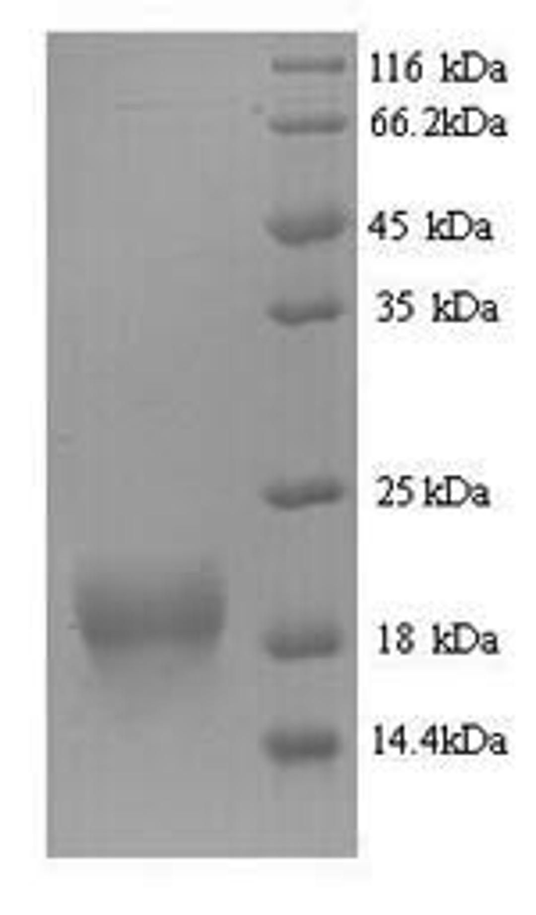 (Tris-Glycine gel) Discontinuous SDS-PAGE (reduced) with 5% enrichment gel and 15% separation gel.