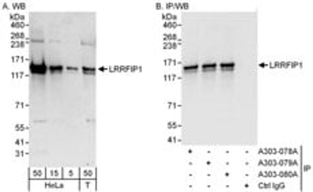 Detection of human LRRFIP1 by western blot and immunoprecipitation.