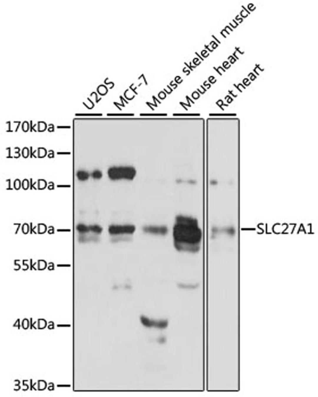 Western blot - SLC27A1 antibody (A12847)