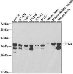 Western blot - TPM1 antibody (A1157)