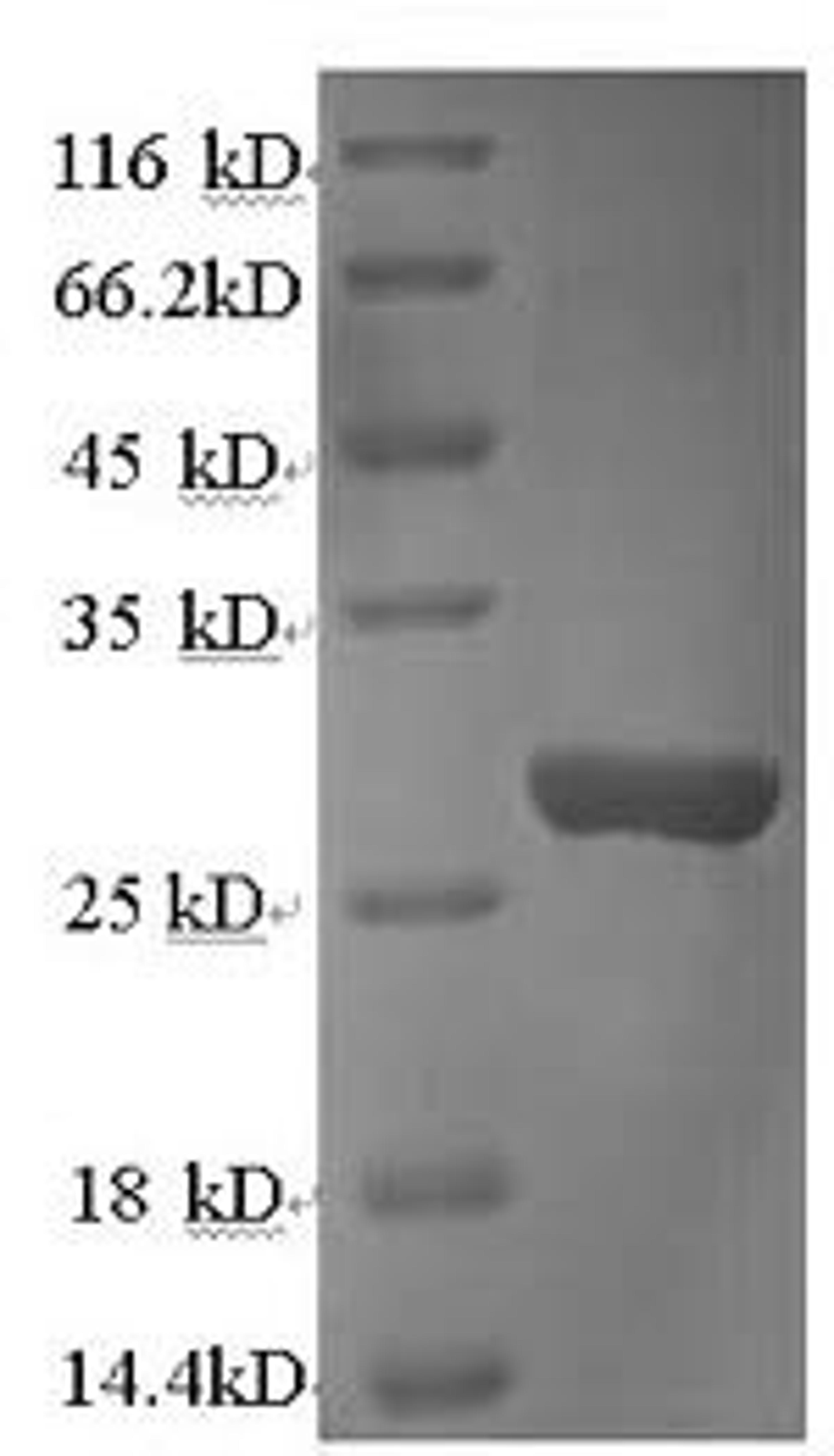 (Tris-Glycine gel) Discontinuous SDS-PAGE (reduced) with 5% enrichment gel and 15% separation gel.