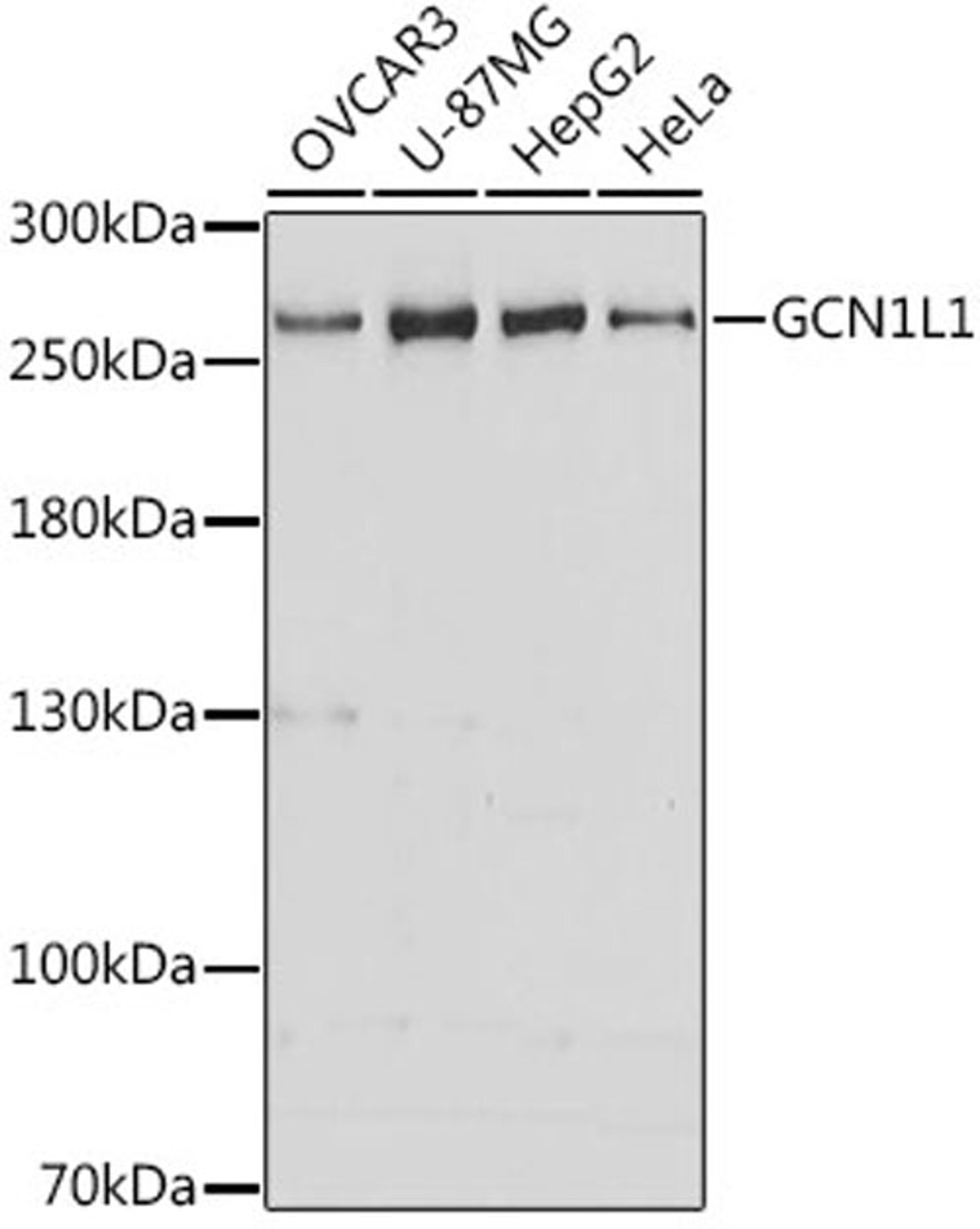 Western blot - GCN1L1 antibody (A13075)