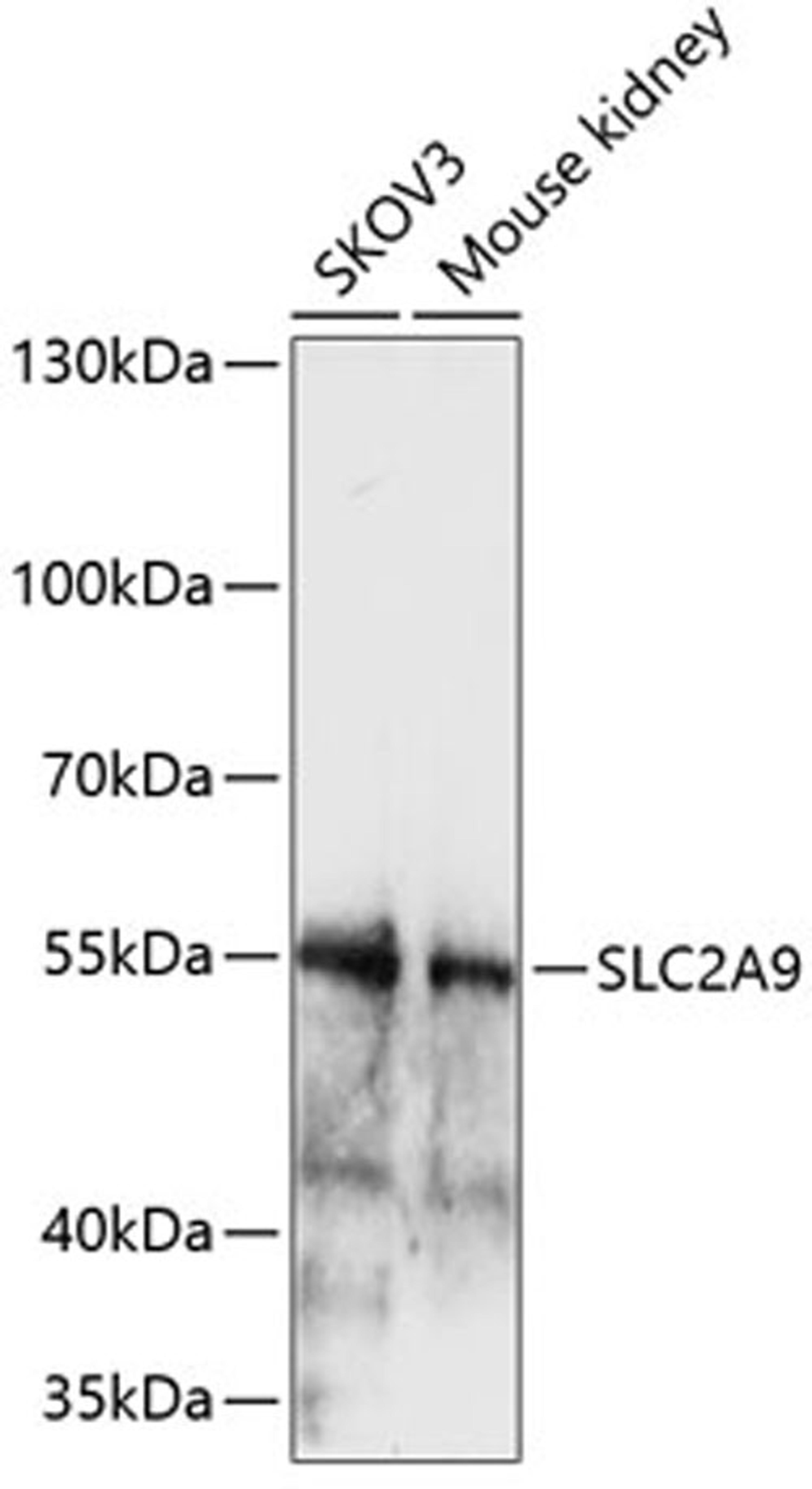 Western blot - SLC2A9 antibody (A14592)