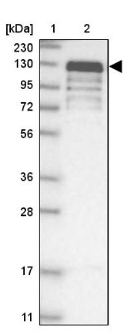 Western Blot: NHSL1 Antibody [NBP1-90025] - Lane 1: Marker [kDa] 230, 130, 95, 72, 56, 36, 28, 17, 11<br/>Lane 2: Human cell line RT-4