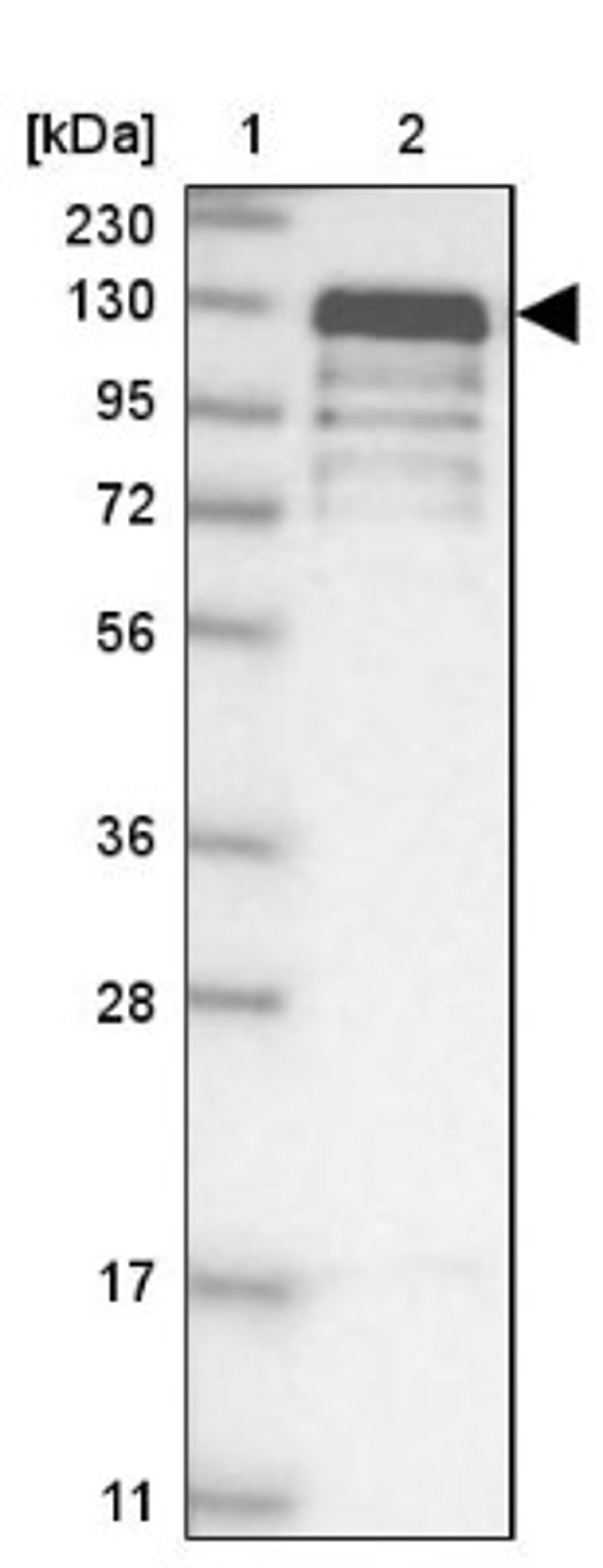 Western Blot: NHSL1 Antibody [NBP1-90025] - Lane 1: Marker [kDa] 230, 130, 95, 72, 56, 36, 28, 17, 11<br/>Lane 2: Human cell line RT-4