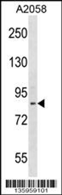 Western blot analysis in A2058 cell line lysates (35ug/lane).