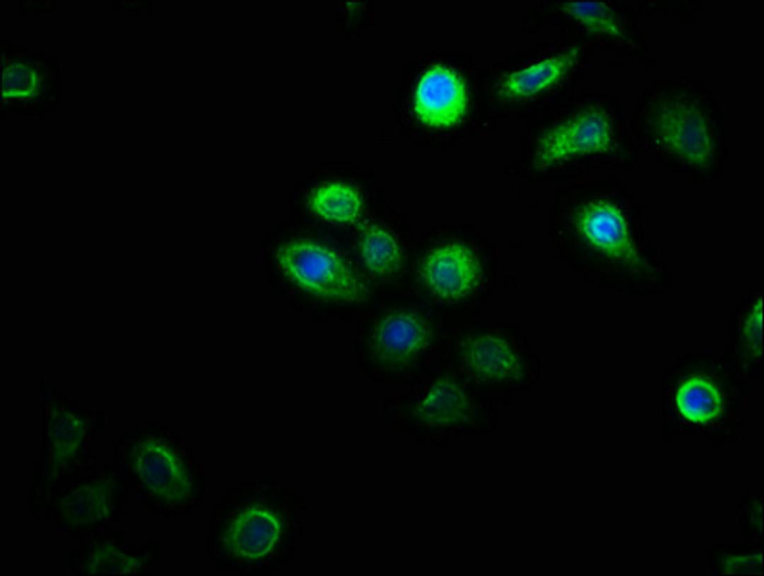 Immunofluorescence staining of A549 cells with CSB-PA836670LA01HU at 1:100, counter-stained with DAPI. The cells were fixed in 4% formaldehyde, permeabilized using 0.2% Triton X-100 and blocked in 10% normal Goat Serum. The cells were then incubated with the antibody overnight at 4°C. The secondary antibody was Alexa Fluor 488-congugated AffiniPure Goat Anti-Rabbit IgG(H+L).