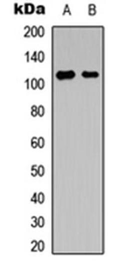 Western blot analysis of Ramos (Lane1), HeLa (Lane2) whole cell using NFAT4 (phospho-S165) antibody