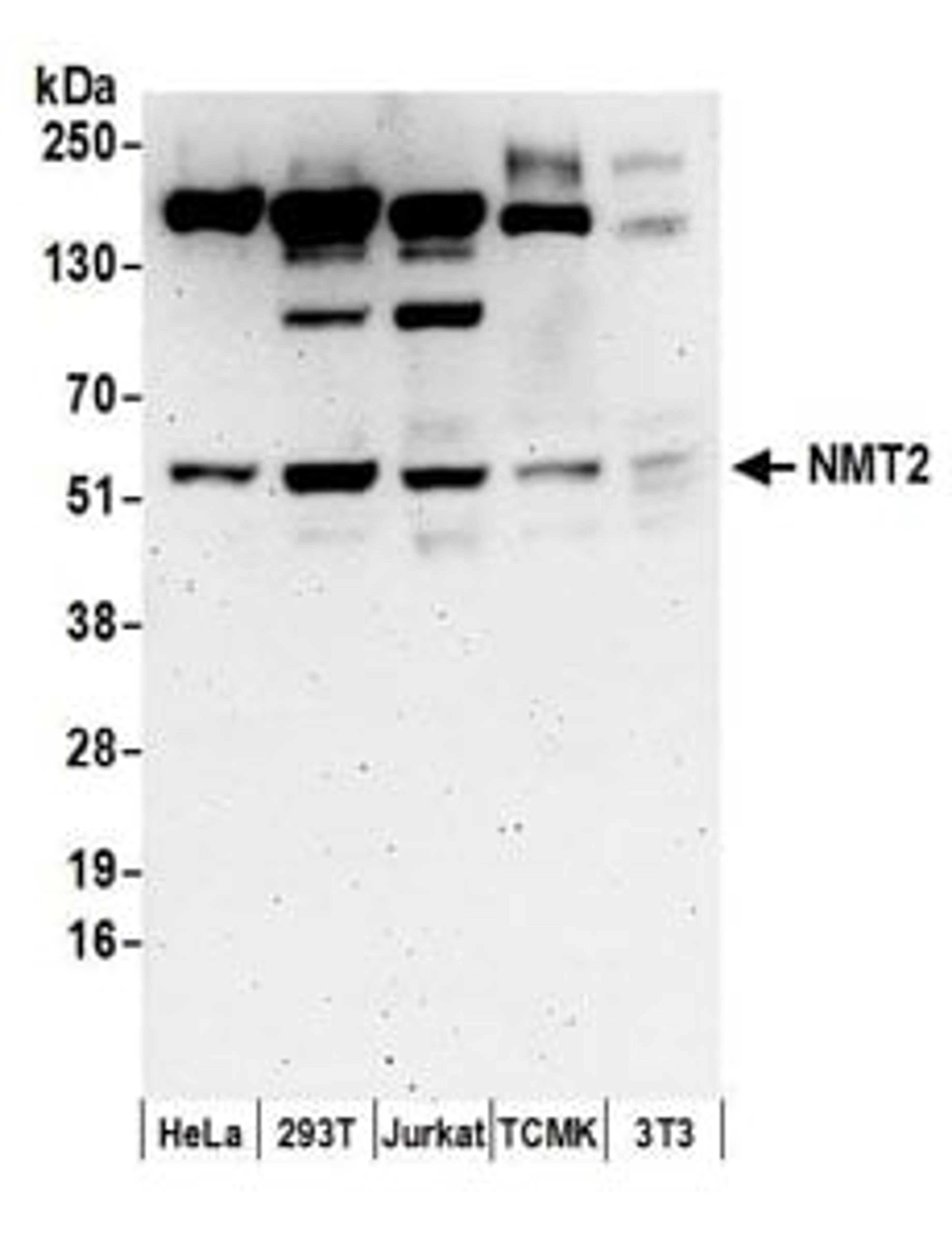 Detection of human and mouse NMT2 by western blot.