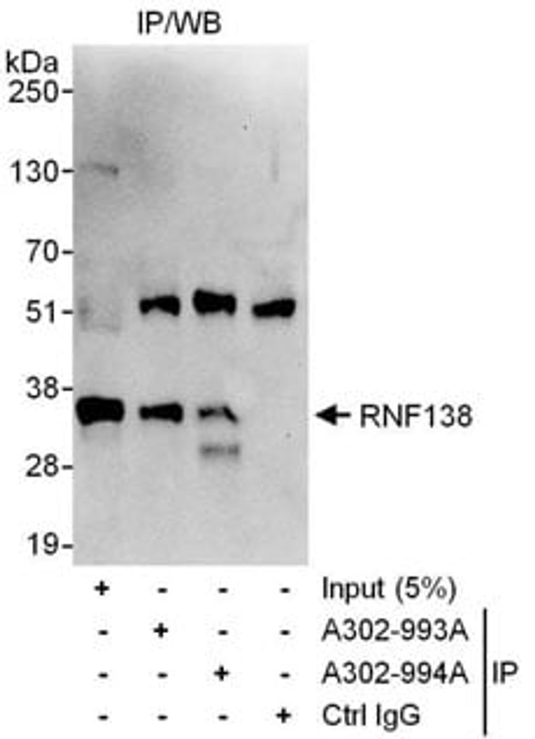 Detection of human RNF138 by western blot of immunoprecipitates.