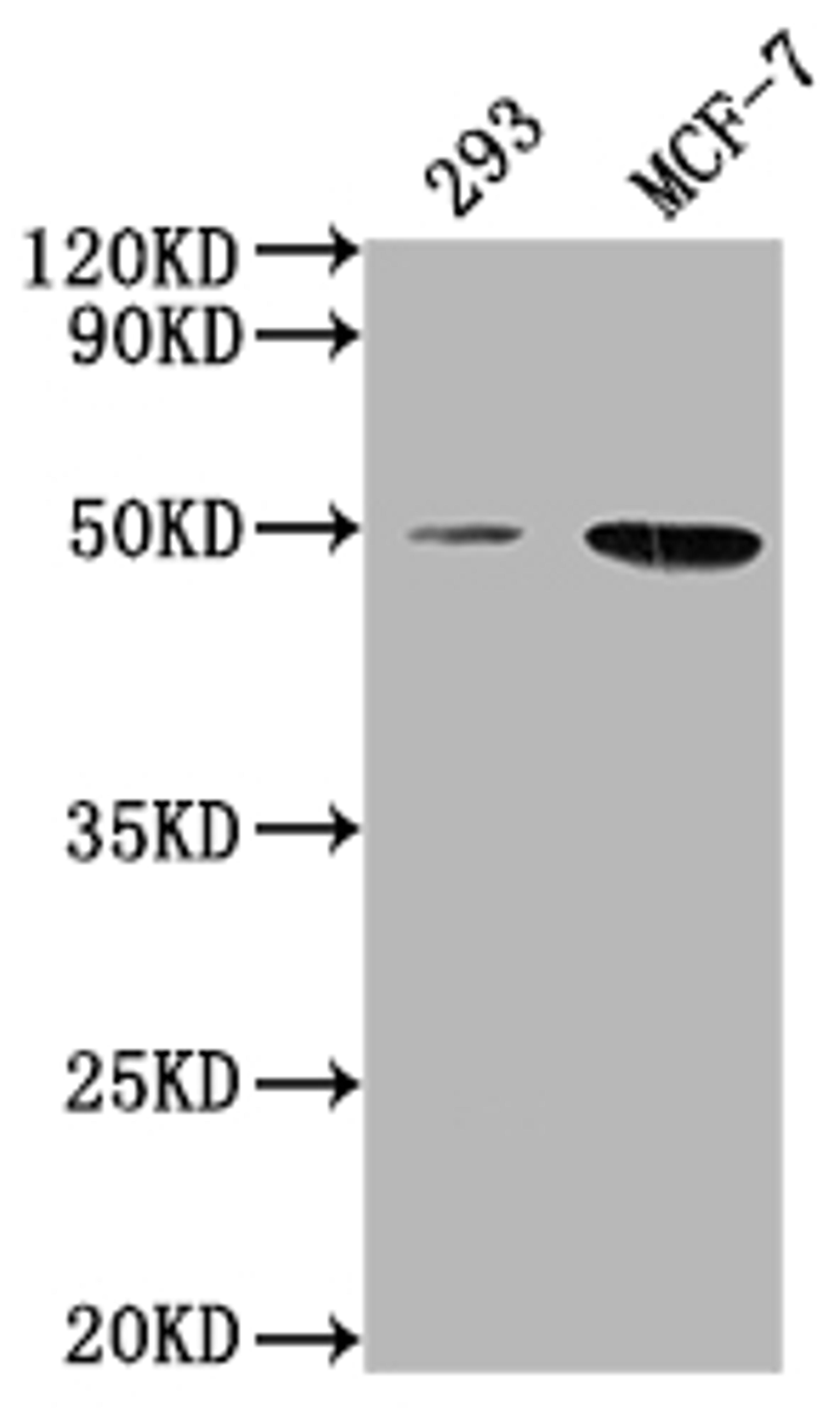 Western Blot. Positive WB detected in: 293 whole cell lysate, MCF-7 whole cell lysate. All lanes: ATF4 antibody at 1:2000. Secondary. Goat polyclonal to rabbit IgG at 1/50000 dilution. Predicted band size: 39 kDa. Observed band size: 50 kDa. 