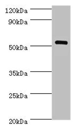 Western blot. All lanes: MEF2C antibody at 1ug/ml + Mouse skeletal muscle tissue. Secondary. Goat polyclonal to rabbit IgG at 1/10000 dilution. Predicted band size: 52, 51, 48, 45, 53 kDa. Observed band size: 52 kDa. 