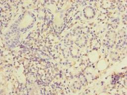 Immunohistochemistry of paraffin-embedded human pancreatic tissue using CSB-PA014767LA01HU at dilution of 1:100