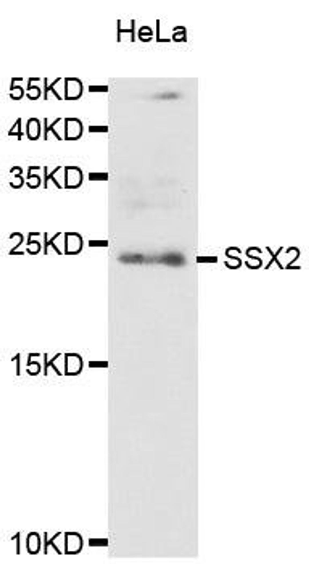 Western blot analysis of extract of HeLa cell lines using SSX2 antibody