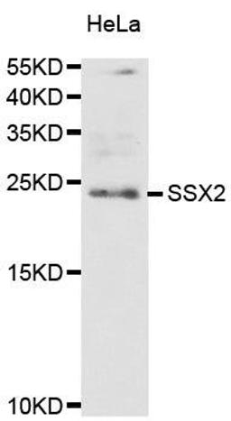 Western blot analysis of extract of HeLa cell lines using SSX2 antibody