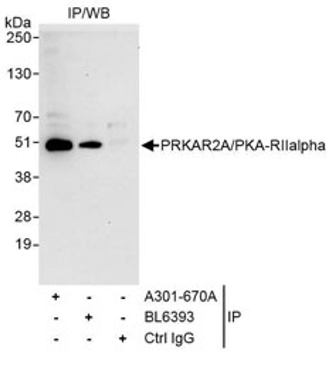 Detection of human PRKAR2A/PKA-RIIalpha by western blot of immunoprecipitates