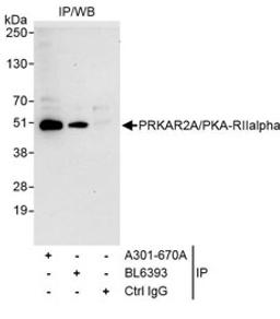 Detection of human PRKAR2A/PKA-RIIalpha by western blot of immunoprecipitates