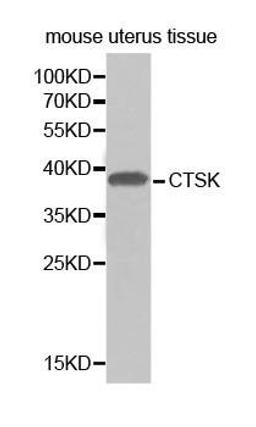 Western blot analysis of extracts of mouse uterus tissue cell line using CTSK antibody