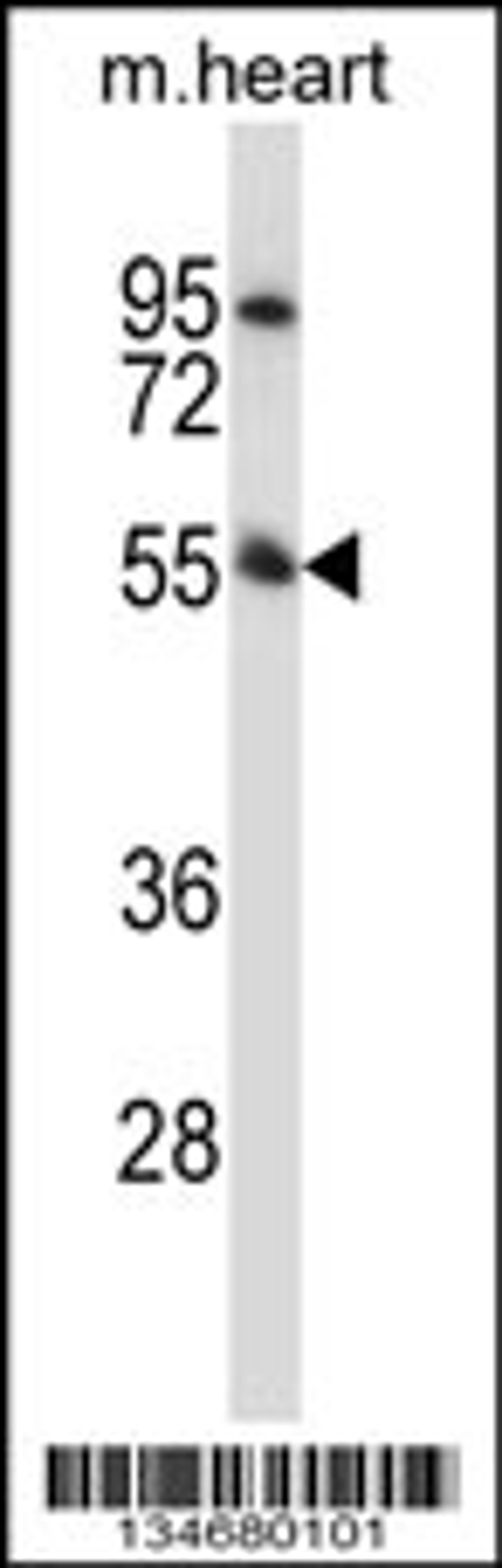 Western blot analysis in mouse heart tissue lysates (35ug/lane).