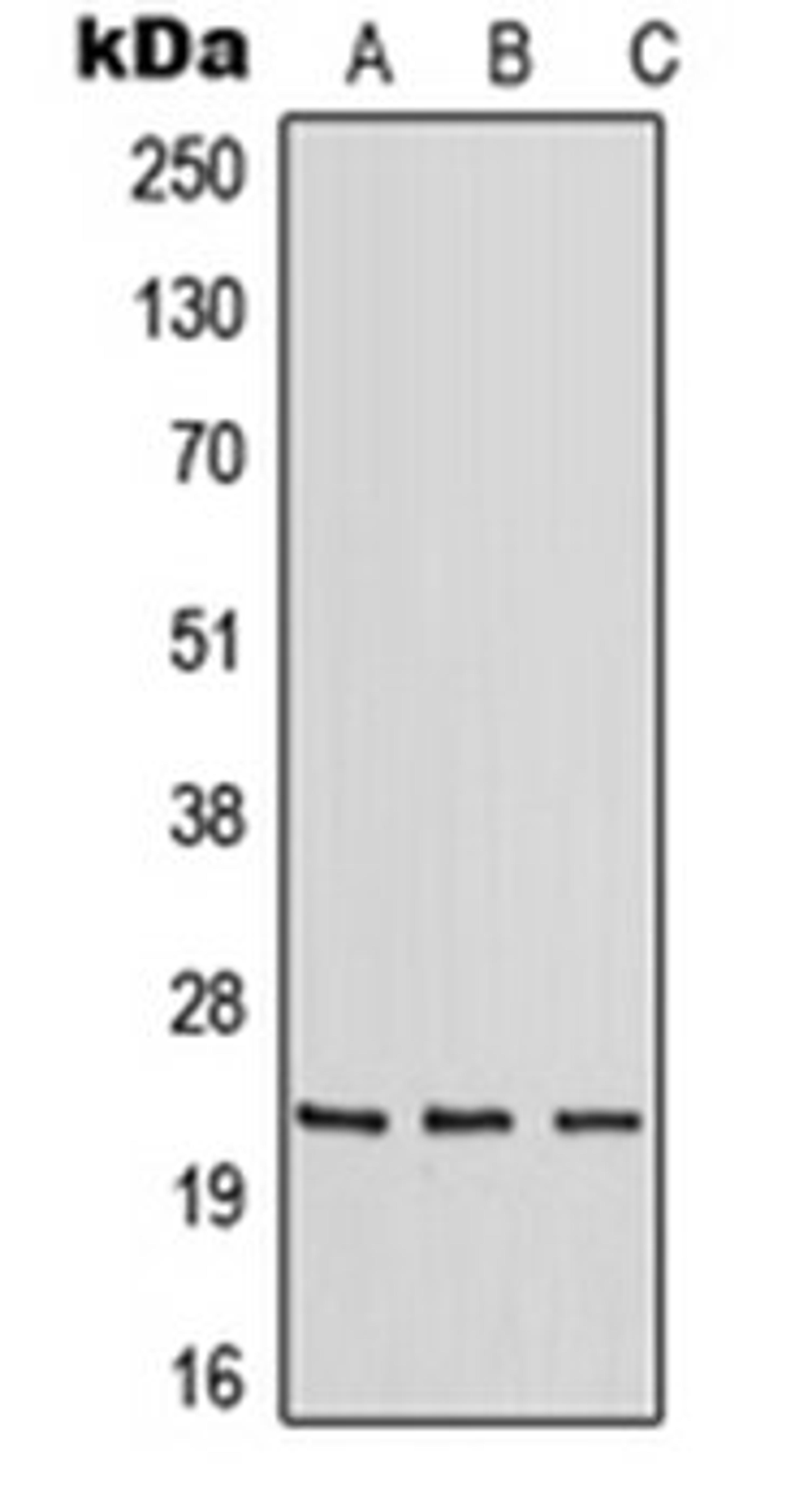 Western blot analysis of HeLa (Lane 1), mouse liver (Lane 2), rat liver (Lane 3) whole cell lysates using RAB30 antibody