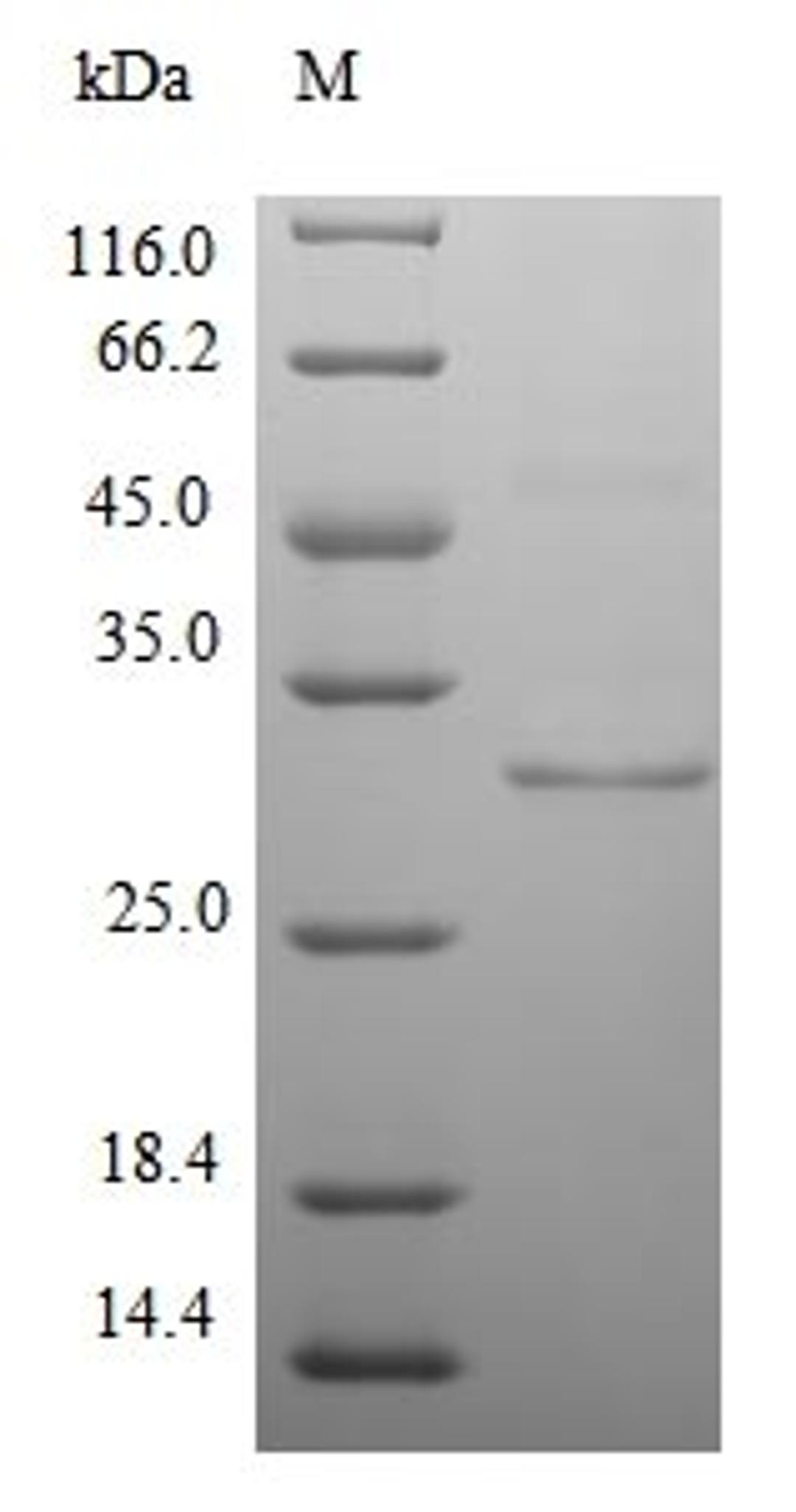 (Tris-Glycine gel) Discontinuous SDS-PAGE (reduced) with 5% enrichment gel and 15% separation gel.