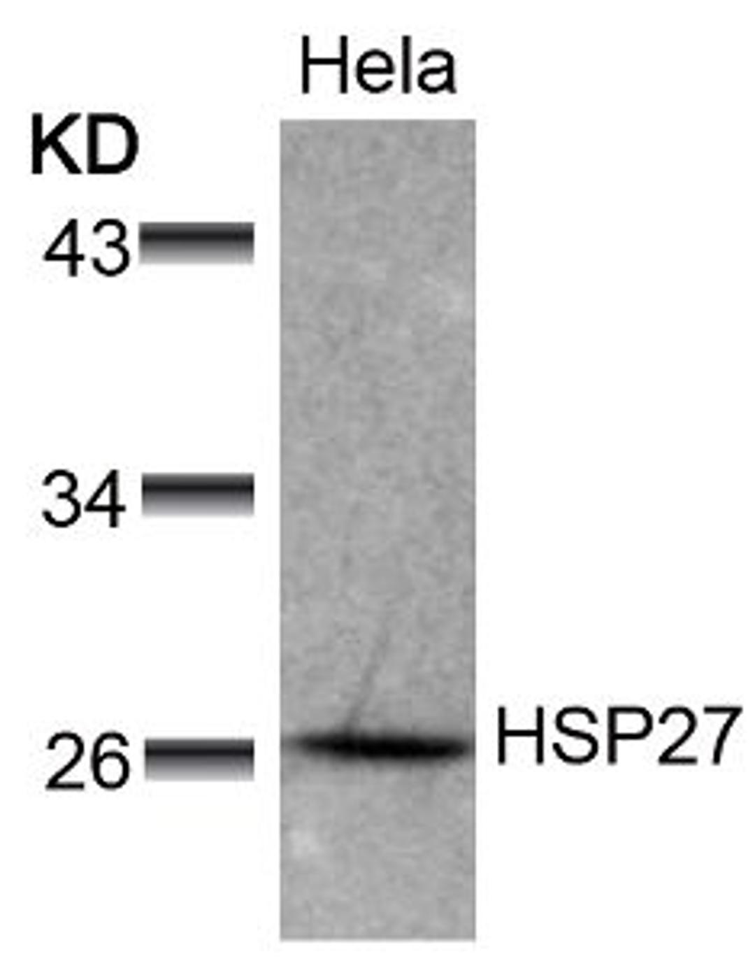 Western blot analysis of lysed extracts from HeLa cells using HSP27 (Ab-78).