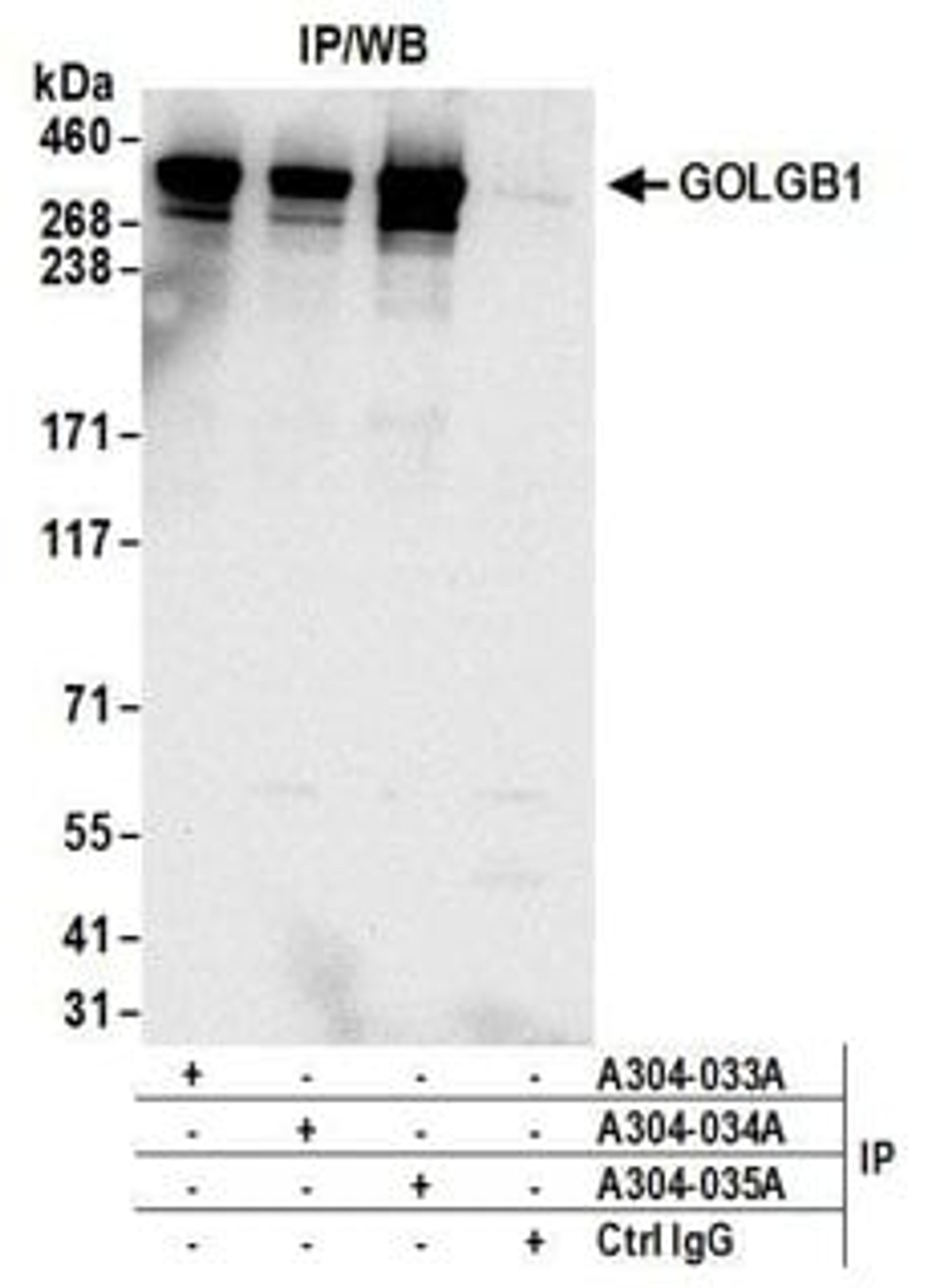 Detection of human GOLGB1 by western blot of immunoprecipitates.