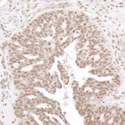 Detection of human Phospho RelA (S536) by immunohistochemistry.