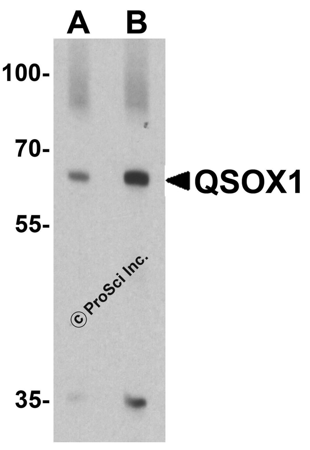 Western blot analysis of QSOX1 in EL4 cell lysate with QSOX1 antibody at (A) 1 and (B) 2 &#956;g/ml.