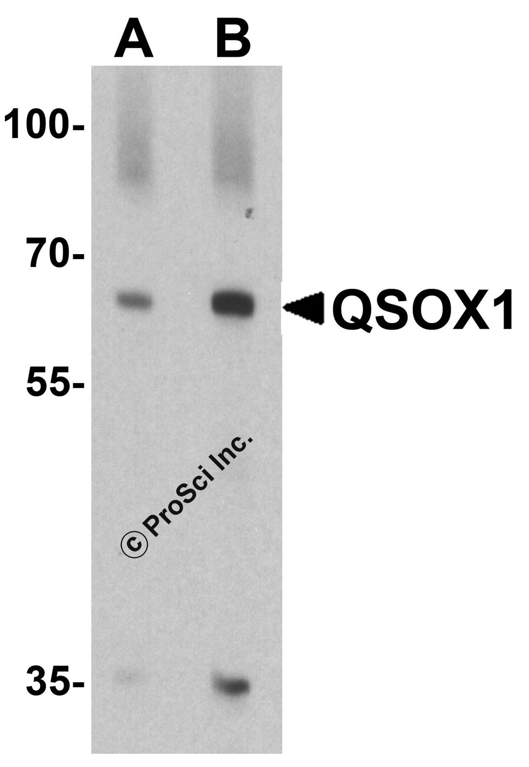 Western blot analysis of QSOX1 in EL4 cell lysate with QSOX1 antibody at (A) 1 and (B) 2 μg/ml.