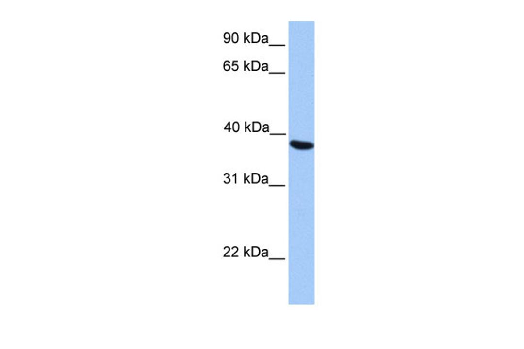 Antibody used in WB on Human HepG2 at 0.2-1 ug/ml.