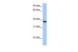 Antibody used in WB on Human HepG2 at 0.2-1 ug/ml.