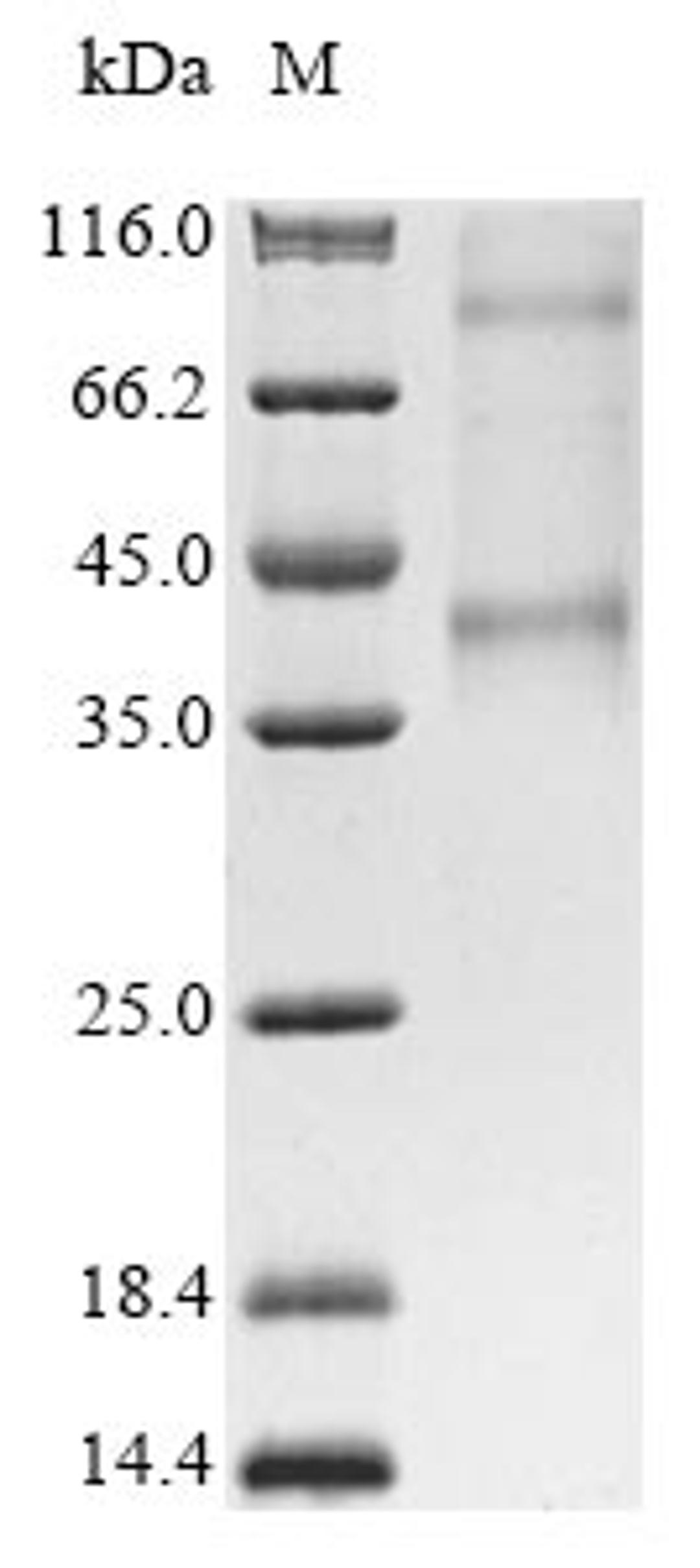 (Tris-Glycine gel) Discontinuous SDS-PAGE (reduced) with 5% enrichment gel and 15% separation gel.