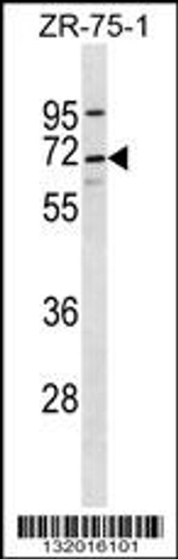 Western blot analysis in ZR-75-1 cell line lysates (35ug/lane).