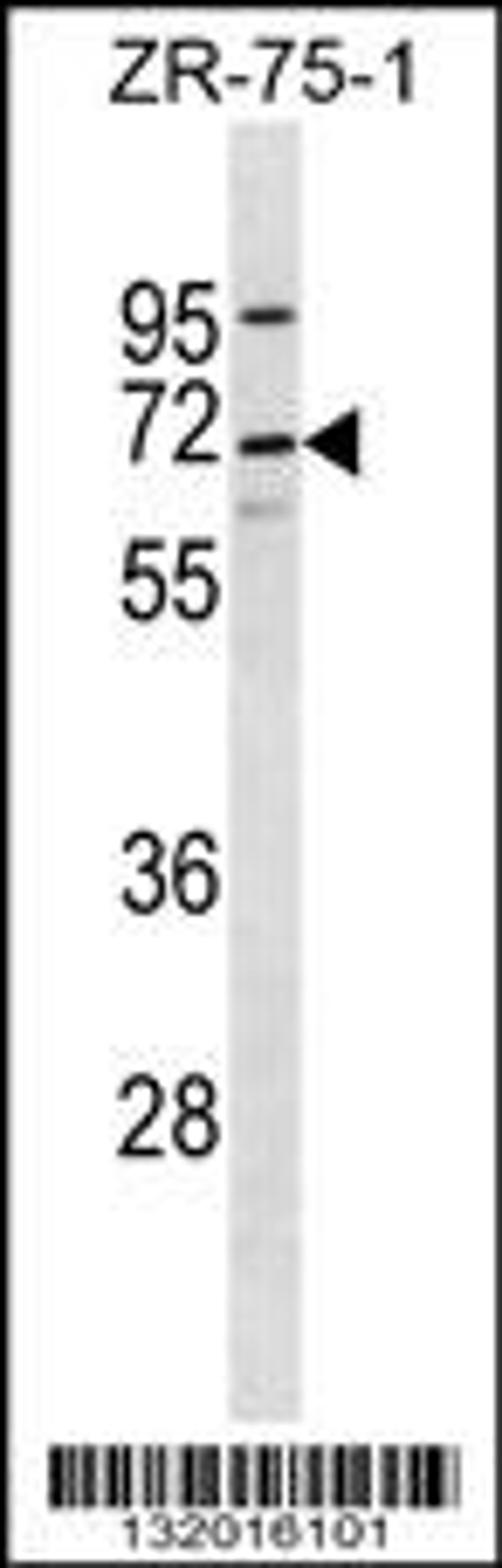 Western blot analysis in ZR-75-1 cell line lysates (35ug/lane).