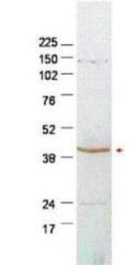 Western blot analysis of HeLa whole cell lysates using Plasminogen Activator Inhibitor 2 antibody