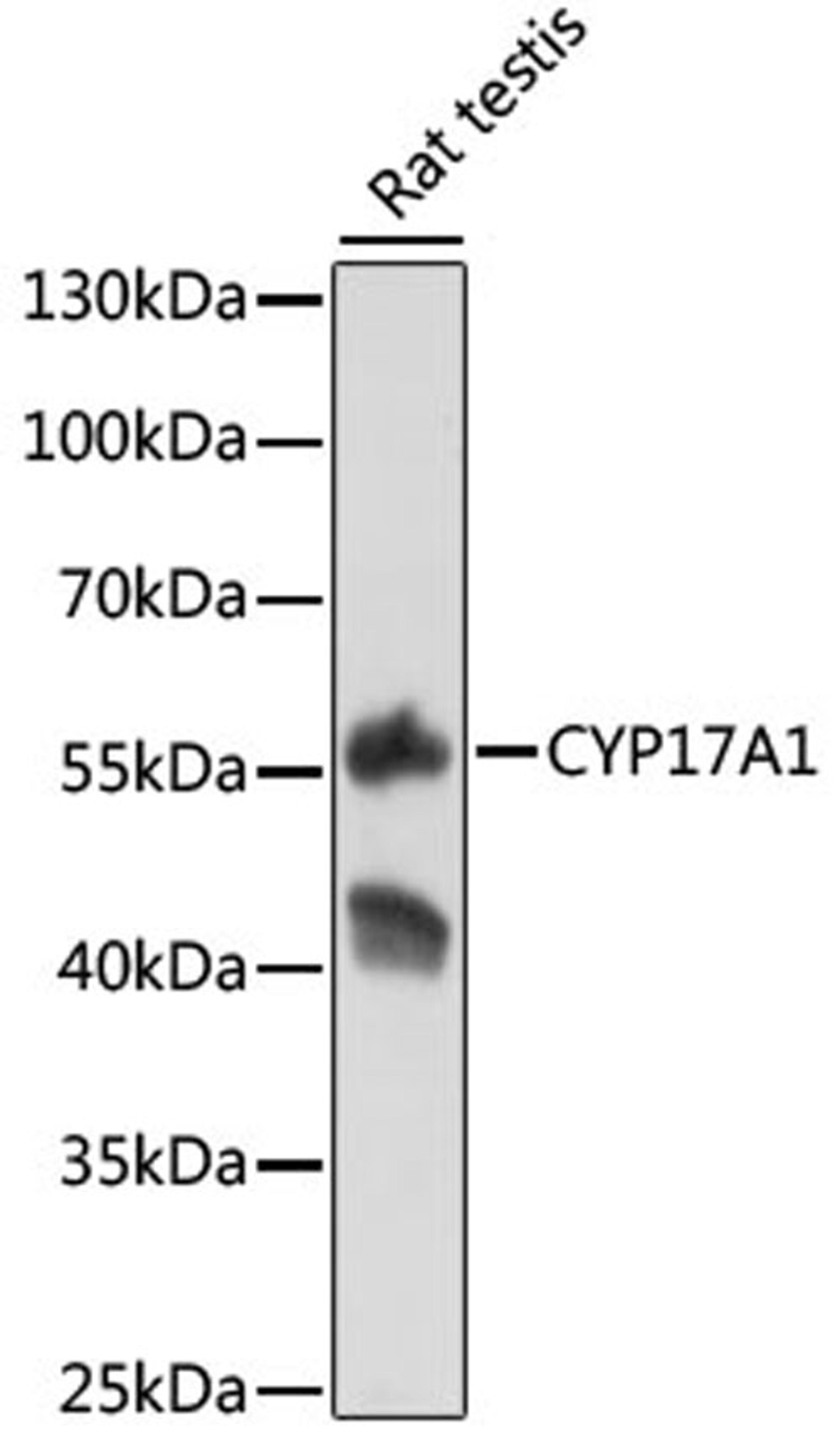 Western blot - CYP17A1 antibody (A1373)