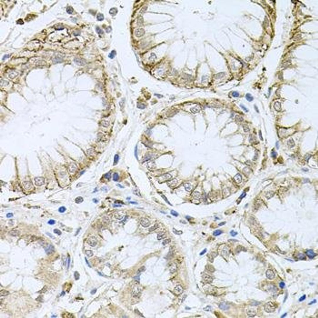 Immunohistochemical staining of mouse stomach tissue using HPS1 antibody (dilution of 1:100)