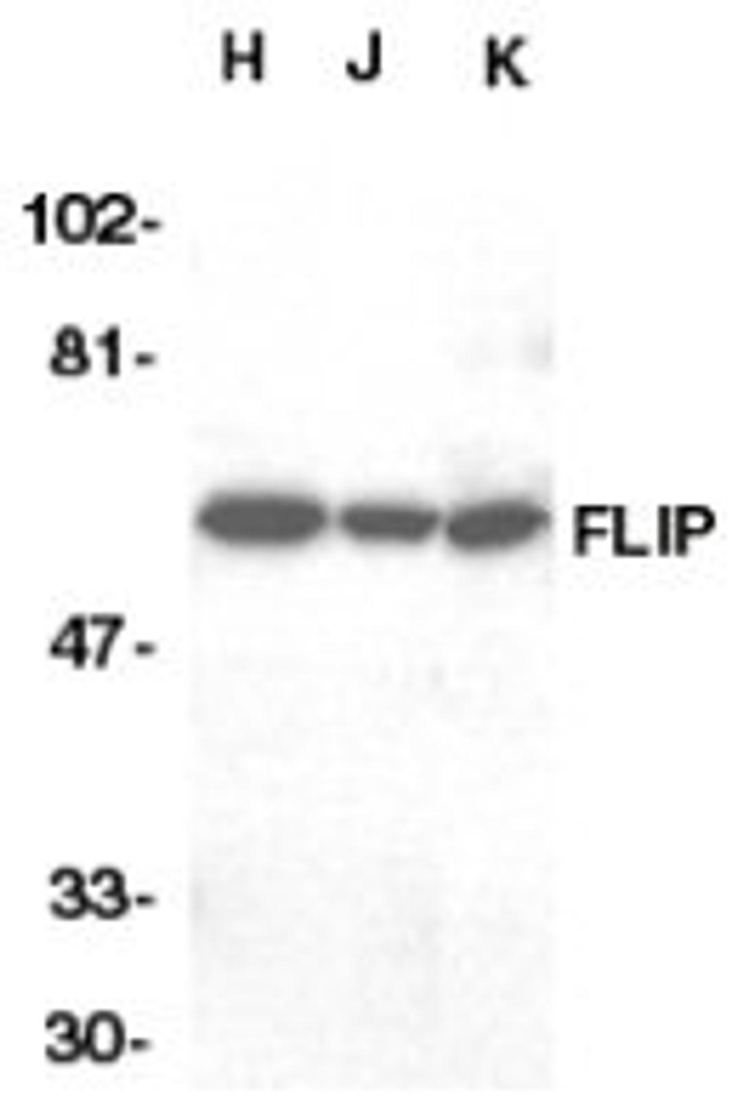 Western blot analysis of whole cell lysates from HeLa, Jurkat and K562 cell lines