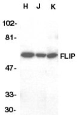 Western blot analysis of whole cell lysates from HeLa, Jurkat and K562 cell lines