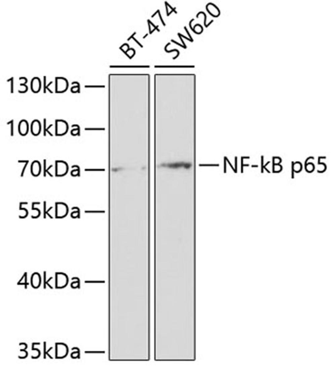 Western blot - NF-kB p65 antibody (A2547)