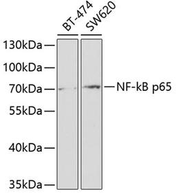 Western blot - NF-kB p65 antibody (A2547)