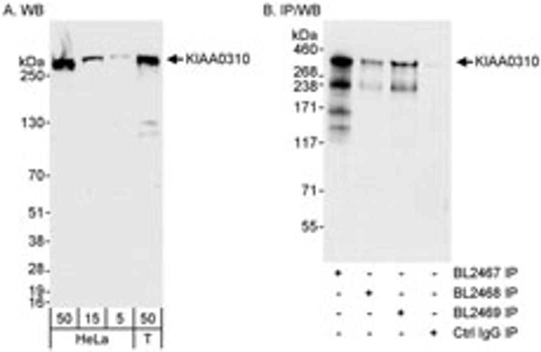 Detection of human KIAA0310 by western blot and immunoprecipitation.