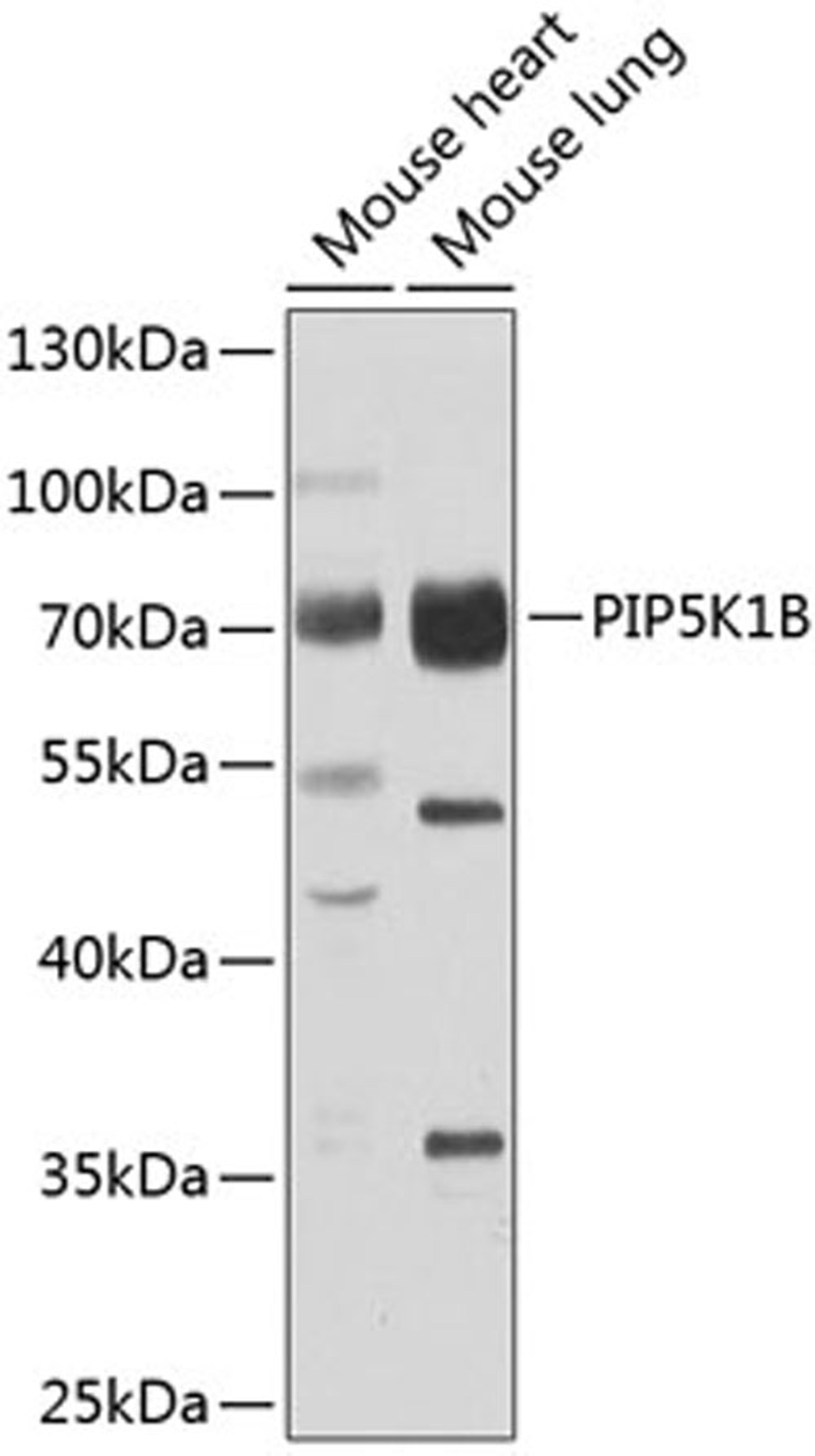 Western blot - PIP5K1B antibody (A7749)